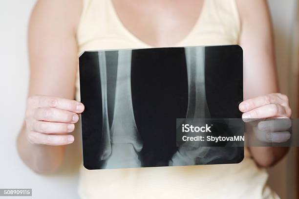Woman Holding An Xray Image Stock Photo - Download Image Now - Adult, Alertness, Anatomy