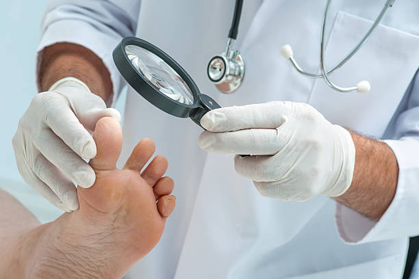 Tinia pedis or Athlete's foot Doctor dermatologist examines the foot on the presence of athlete's foot trichophyton fungus stock pictures, royalty-free photos & images