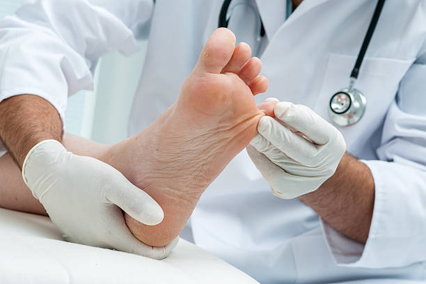 tinia pediküre oder athlete's foot - podiatry chiropody toenail human foot stock-fotos und bilder