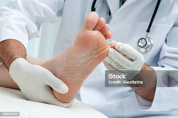 Tinia Pedis Or Athletes Foot Stock Photo - Download Image Now - Athlete's Foot, Podiatrist, Care