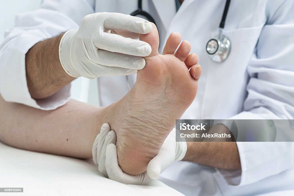 Tinia pedis or Athlete's foot Doctor dermatologist examines the foot on the presence of athlete's foot Podiatrist Stock Photo