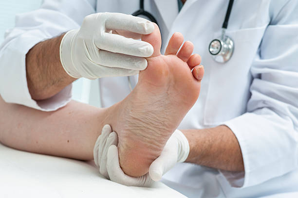 Tinia pedis or Athlete's foot Doctor dermatologist examines the foot on the presence of athlete's foot fungus stock pictures, royalty-free photos & images