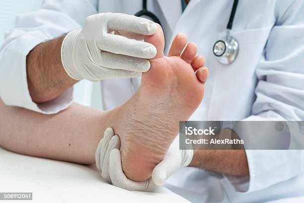 Tinia Pedis Or Athletes Foot Stock Photo - Download Image Now - Podiatrist, Doctor, Healthcare And Medicine