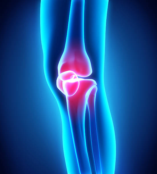 istock Painful Knee Illustration 509315921