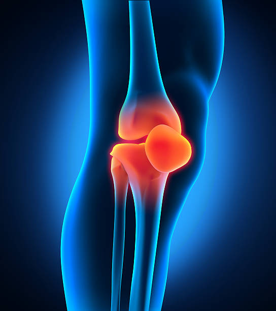 동통성 무릎 일러스트 - cartilage patella human knee medical exam 뉴스 사진 이미지