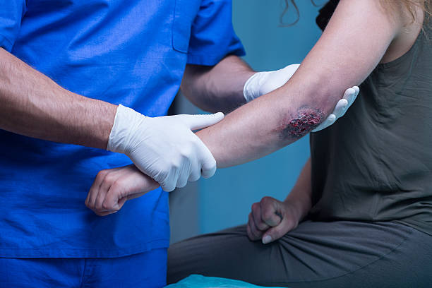istock Woman with bruised elbow 509425398