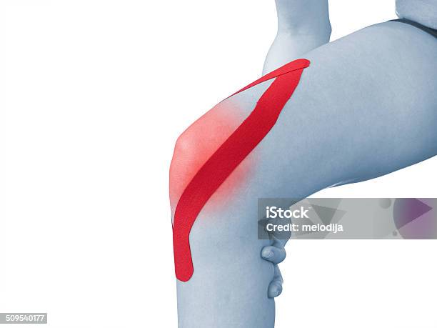 Acute Pain In A Woman Knee Stock Photo - Download Image Now - Adult, Adults Only, Anatomy