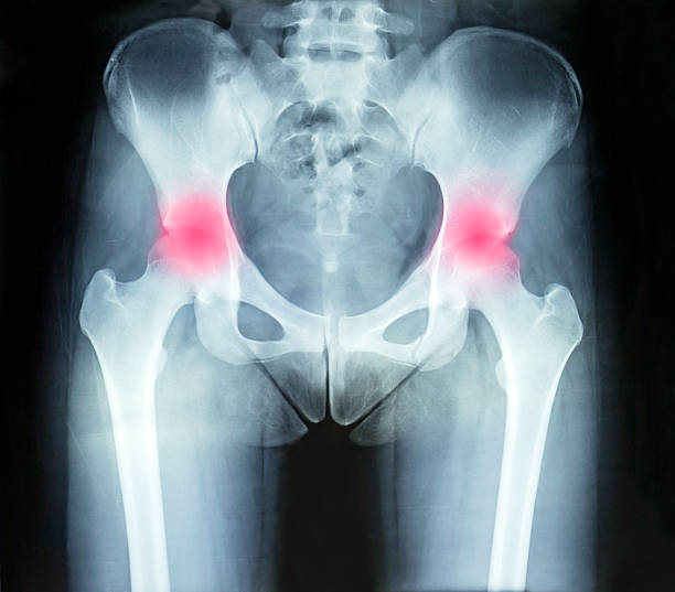 x-ray du film - x ray image coccyx radiologist hip photos et images de collection