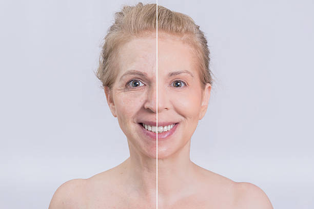 istock Before and after skin treatment 509627976
