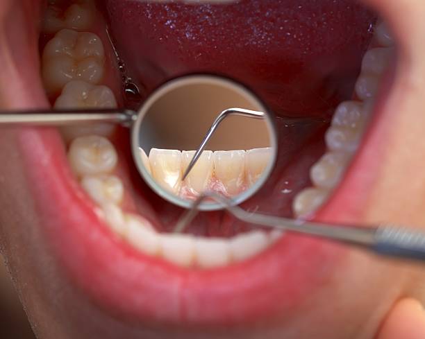 обширные стоматологическое обследование - human saliva стоковые фото и изображения