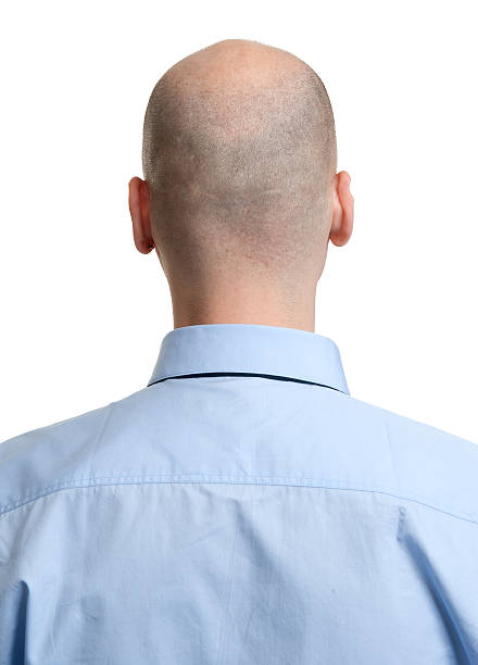 istock adult man bald head rear view 509728753
