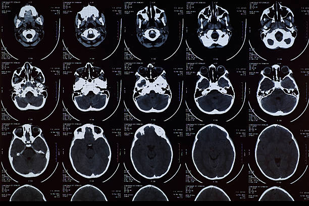 MRI Scan stock photo