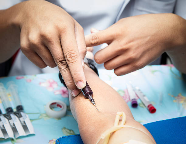 obtención de muestras de sangre - surgical needle syringe prick injecting fotografías e imágenes de stock