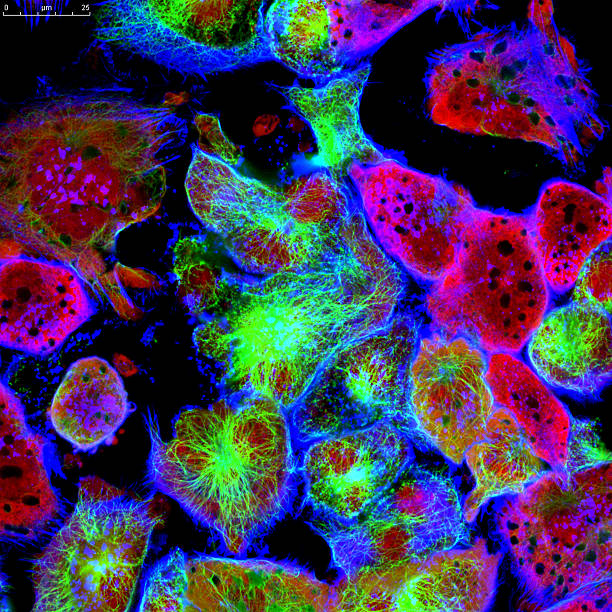 tumore delle cellule del microscopio - luce micrograph foto e immagini stock
