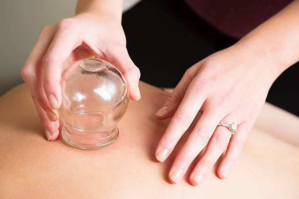 Spa therapist performs massage cupping therapy Spa therapist uses the ancient technique of vacuum cupping on a patient's back. You might also be interested in these: cupping therapy stock pictures, royalty-free photos & images