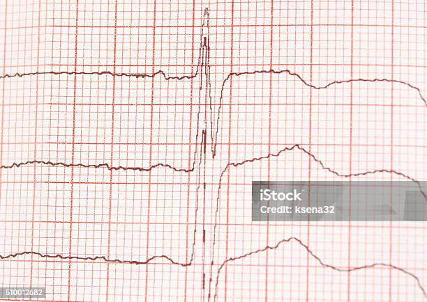 L Ecg Graph Stock Photo - Download Image Now - Aorta, Chart, Close-up