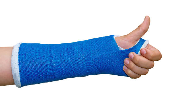 Broken arm -  thumb up Broken arm in a cast on a white background. Fingers show the character all right eurasian griffon vulture photos stock pictures, royalty-free photos & images