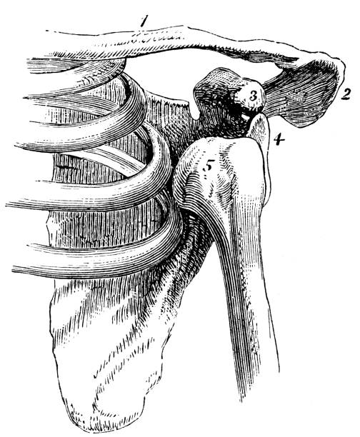 antyczne ilustracja medycznych i naukowych o wysokiej rozdzielczości: ramię zwichnięcie - humerus stock illustrations