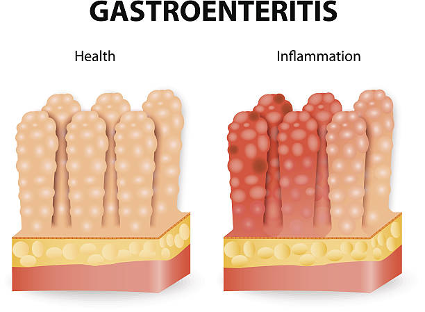 illustrations, cliparts, dessins animés et icônes de gastroentérite ou infectieuse diarrhée - cramping