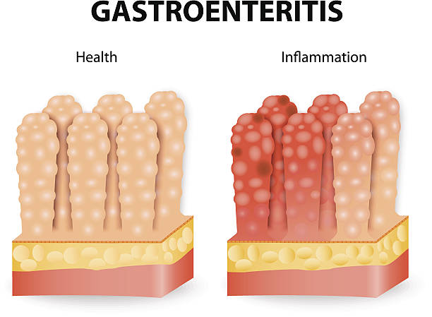 zapalenie żołądka i jelit lub biegunka zakaźna - norovirus diarrhea gastroenteritis virus stock illustrations