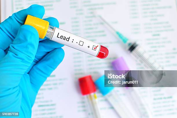 Lead Testing Positive Stock Photo - Download Image Now - Lead, Poisonous, Medical Test