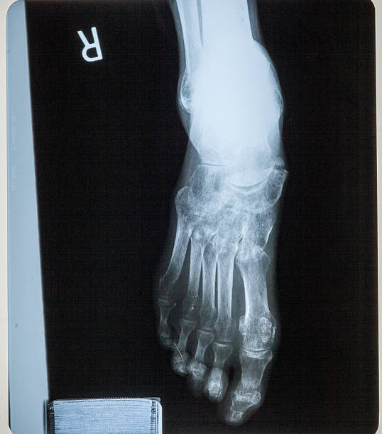 cheville carrés & les douleurs articulaires du genou humain x-ray du film à résonance magnétique - human joint human knee pain x ray photos et images de collection