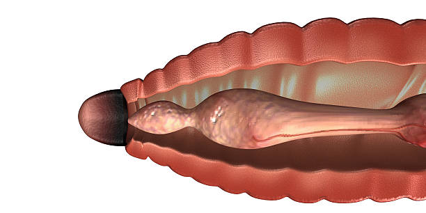 istock Earthworm Anatomy 510632839