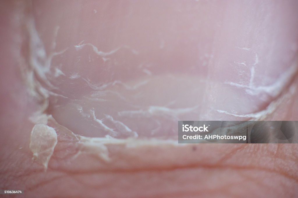 Toe and nail close up An unattractive, non manicured toe Body Part Stock Photo