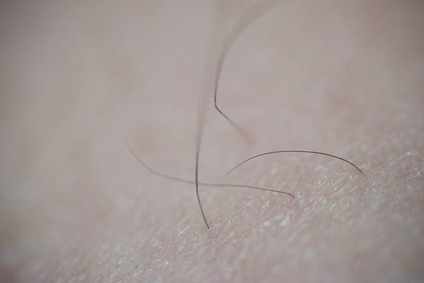 325 Pubic Pictures Pictures Stock Photos, Pictures & Royalty-Free Images - iStock 325 Pubic Pictures Pictures Stock Photos, Pictures & Royalty-Free Images - iStock