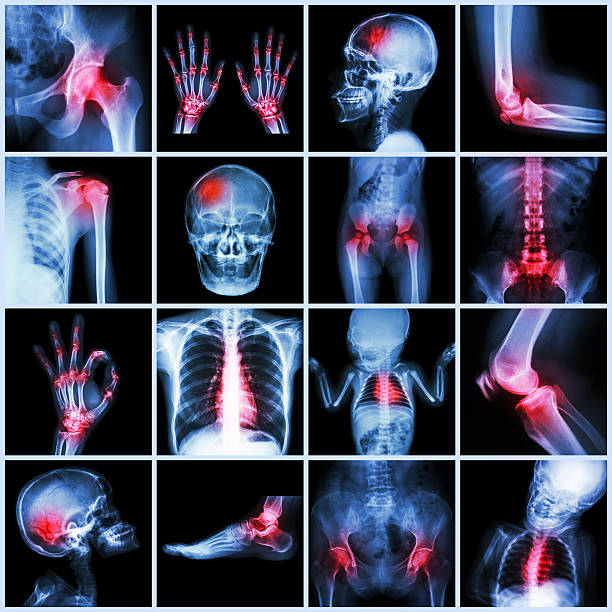 raccolta di raggi x più umana e artrite, più malattia - doctor brain x ray x ray image foto e immagini stock