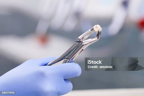 Tooth Extraction Stock Photo - Download Image Now - Removing, Dental Equipment, Dental Health