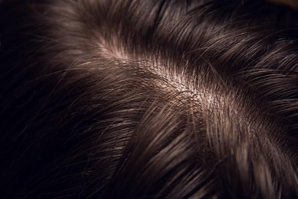 istock hair and head skin close up 510846138
