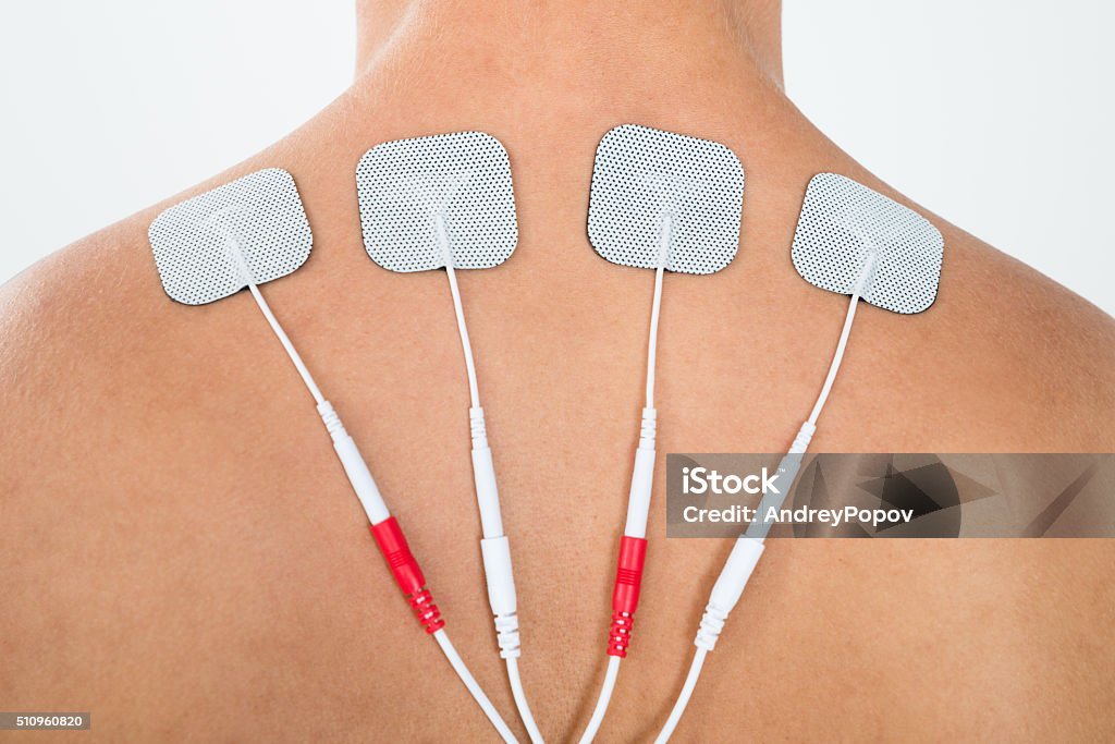 Man With Electrodes On His Back Close-up Of Man With Electrostimulator Electrodes On His Back Active Lifestyle Stock Photo