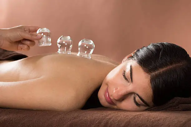 Photo of Woman Getting Cupping Treatment At Spa