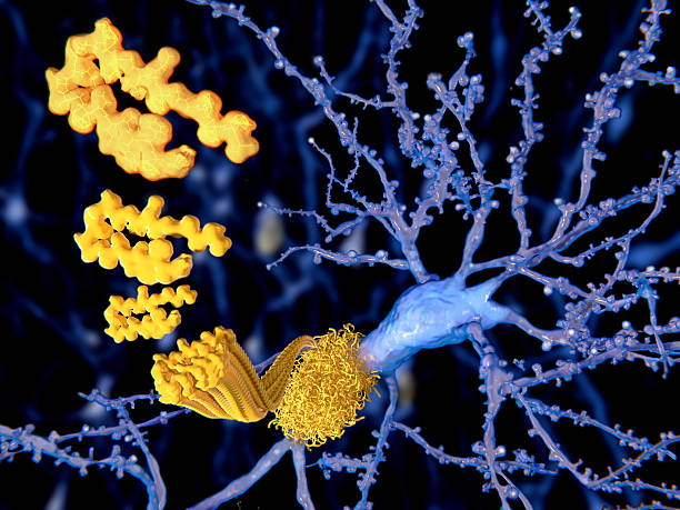 베타 아밀로이드 peptid, 아밀로이드 플라크의 alzheimer disease - 마이크로글리아 뉴스 사진 이미지