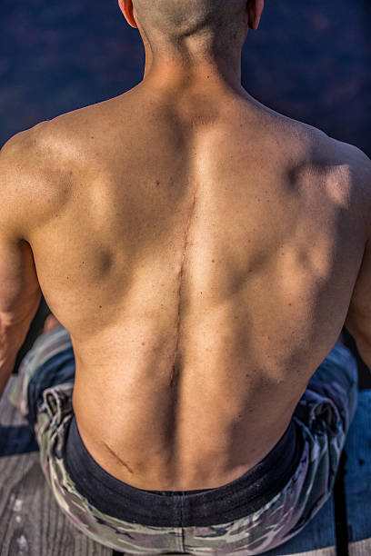 istock Body Of The Scar 511059562