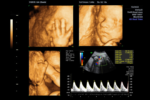 3D Ultrasound scan of body of fetus or baby during pregnancy. This is taken at week 29 during the development of the child. Babies hand, foot and face is visible. Also diagram showing heart beat / pulse and blood flow