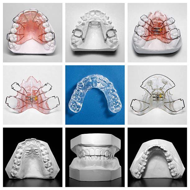 fermo essix circondato da orthodontic elettrodomestici e modelli di studio - human teeth healthcare and medicine medicine equipment foto e immagini stock