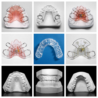 Compilation picture of essix retainer surrounded by orthodontic appliances and study models