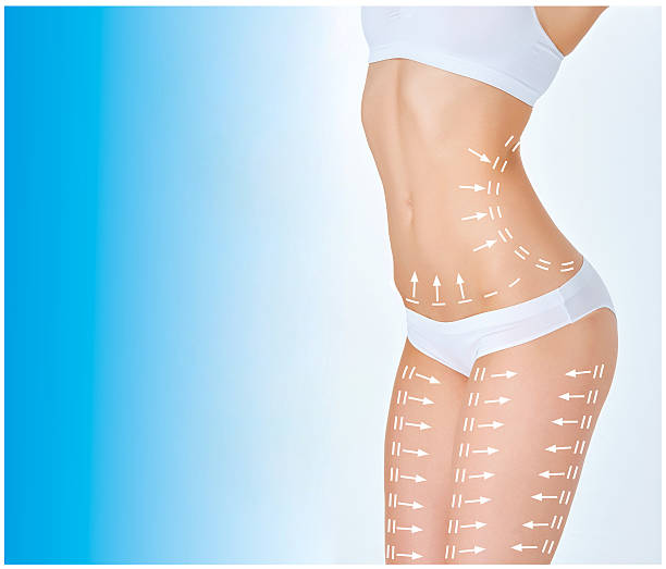 istock The cellulite removal plan. White markings on young woman body 511674378