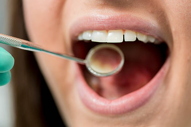istock Young woman at the dentist 511776087