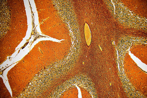 lidské mozečku - histoligický skluzavka - ganglion - stock snímky, obrázky a fotky