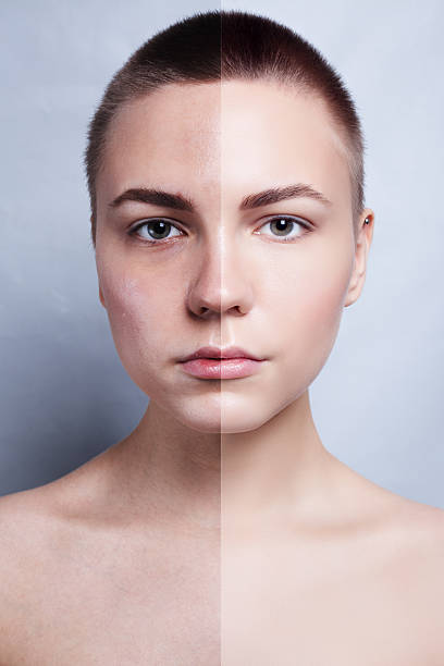 Before and after cosmetic operation. Young pretty woman portrait Before and after cosmetic operation. Young pretty woman portrait, isolated on a white background. Before and after cosmetic or plastic procedure, anti-age therapy teenage girl before and after make up stock pictures, royalty-free photos & images