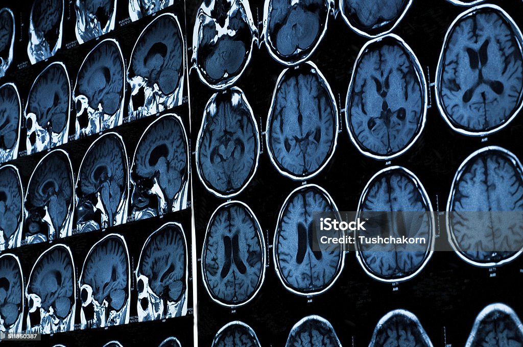 research in medicine. MRI scan of the patient. Radiologist Stock Photo