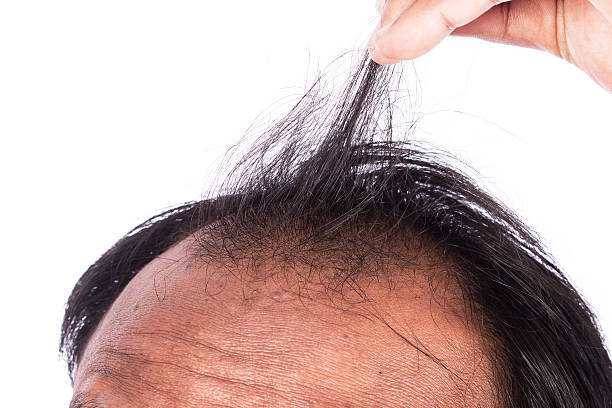 istock young men show hair 511869186