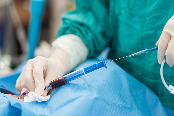 istock apply guide wire in internal carotid vein 511949737