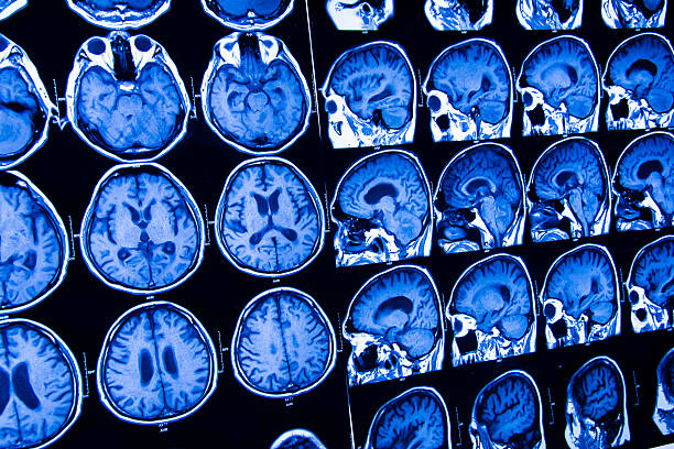 la investigación en el ámbito de la medicina. la ct de la paciente. - disquisition fotografías e imágenes de stock