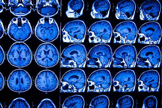 la investigación en el ámbito de la medicina. la ct de la paciente. - disquisition fotografías e imágenes de stock