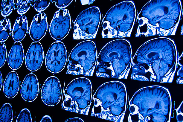 la investigación en el ámbito de la medicina. la ct de la paciente. - disquisition fotografías e imágenes de stock