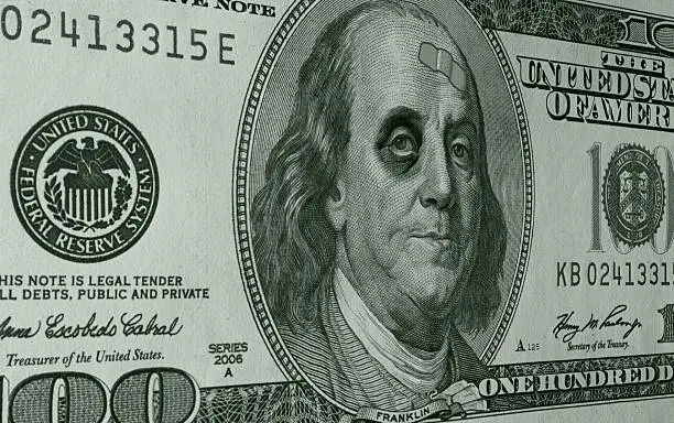 Ben Franklin with sports a shiner (black eye) and a band-aid on the face of a US One Hundred Dollar Bill (C-Note) as an illustration of the weak dollar.